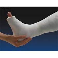 فروش باند گچی برای گچ‌ گیری + قیمت خرید به‌ صرفه